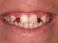 Konig Center for Cosmetic & Comprehensive Dentistry smile photos
